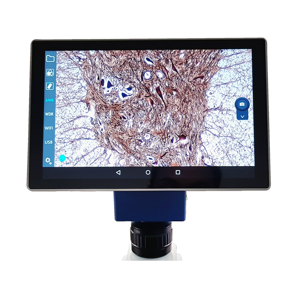 Tablet con camara para mcrpio. Modelo VE-SCOPEPAD 300