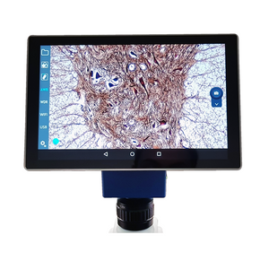 Tablet con camara para mcrpio. Modelo VE-SCOPEPAD 300